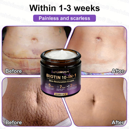 ❤️Happy Mother's Day✨LUMIVO® Biotin 10-in-1 Skin Restoration Cream 🍀
