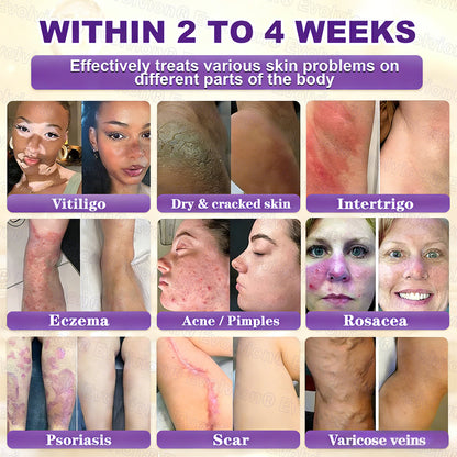 ❤️Happy Mother's Day✨LUMIVO® Biotin 10-in-1 Skin Restoration Cream 🍀