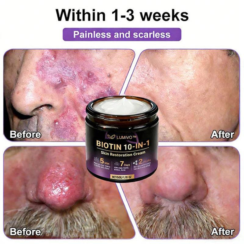 ❤️Happy Mother's Day✨LUMIVO® Biotin 10-in-1 Skin Restoration Cream 🍀