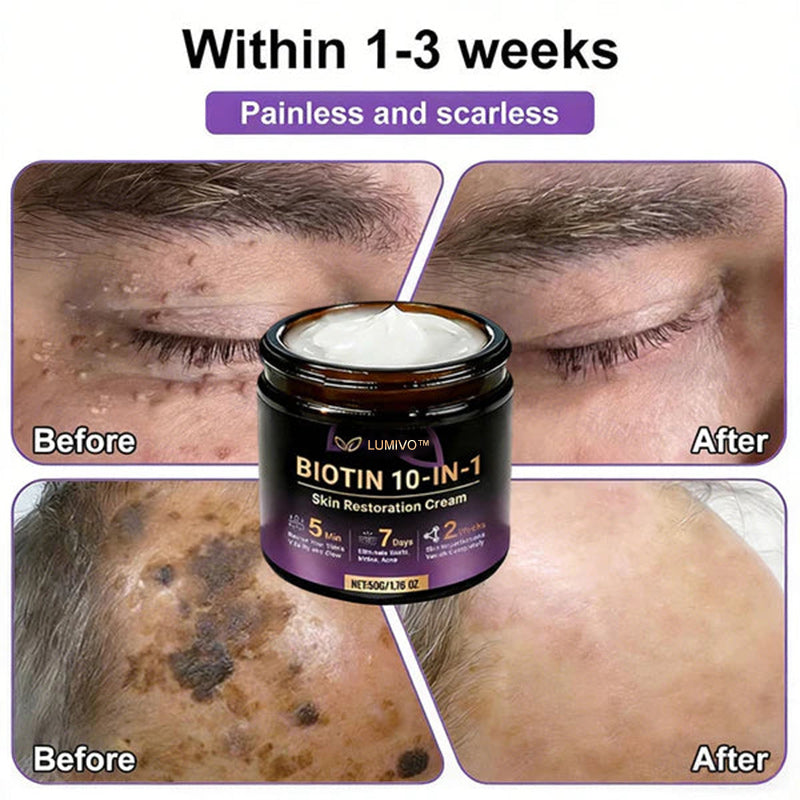 ❤️Happy Mother's Day✨LUMIVO® Biotin 10-in-1 Skin Restoration Cream 🍀