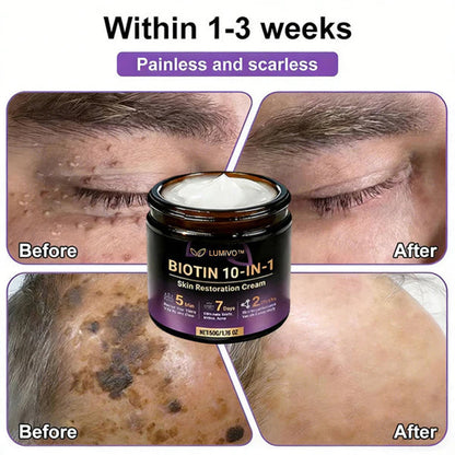 ❤️Happy Mother's Day✨LUMIVO® Biotin 10-in-1 Skin Restoration Cream 🍀