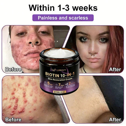 ❤️Happy Mother's Day✨LUMIVO® Biotin 10-in-1 Skin Restoration Cream 🍀