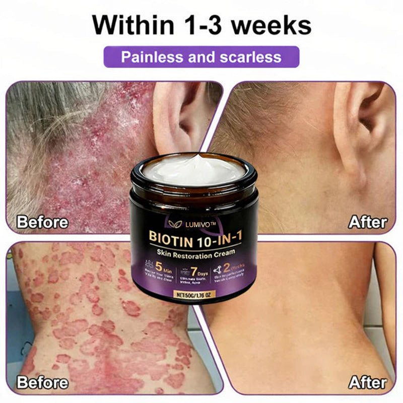 Ends Today: 80% OFF!✨LUMIVO® Biotin 10-in-1 Skin Restoration Cream 🍀Made and Shipped from USA