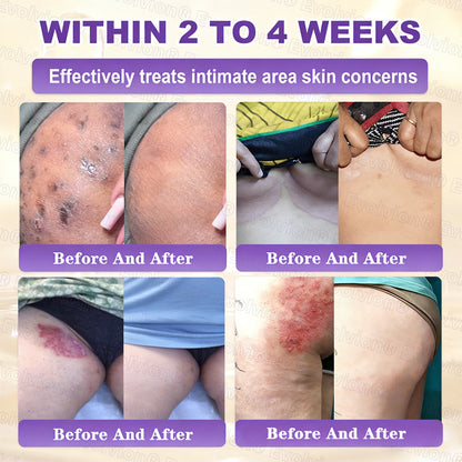 ❤️Happy Mother's Day✨LUMIVO® Biotin 10-in-1 Skin Restoration Cream 🍀