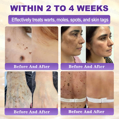 ❤️Happy Mother's Day✨LUMIVO® Biotin 10-in-1 Skin Restoration Cream 🍀