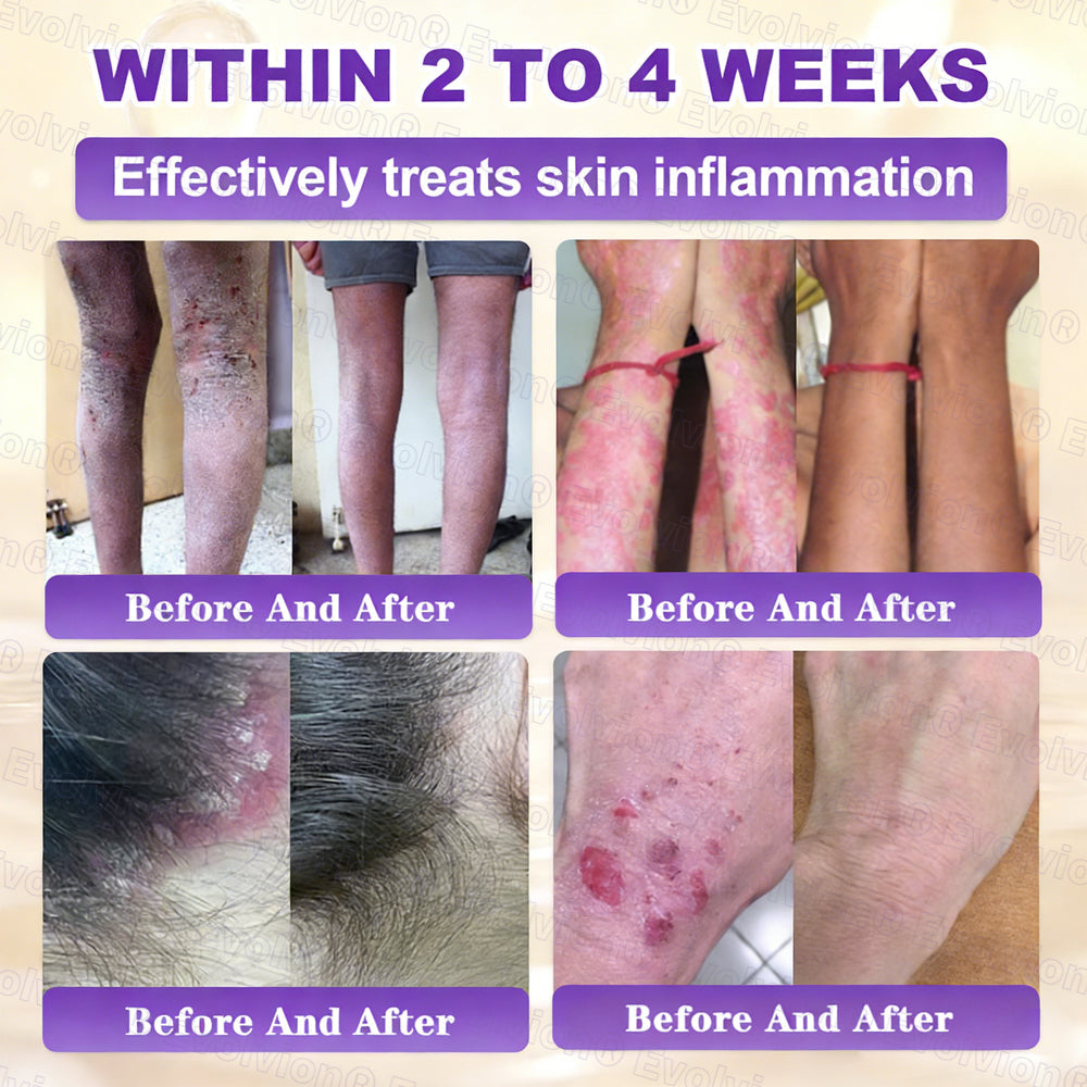 ❤️Happy Mother's Day✨LUMIVO® Biotin 10-in-1 Skin Restoration Cream 🍀