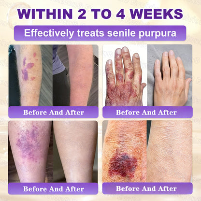 Ends Today: 80% OFF!✨LUMIVO® Biotin 10-in-1 Skin Restoration Cream 🍀Made and Shipped from USA
