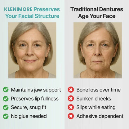 ✨Up to 70% off today only!🔥 Medical Full Denture with Strong Suctiond🦷Obtain American Dental Association (ADA) Certification